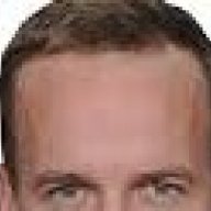 Peytons Forehead